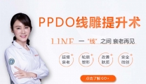 线雕提升术